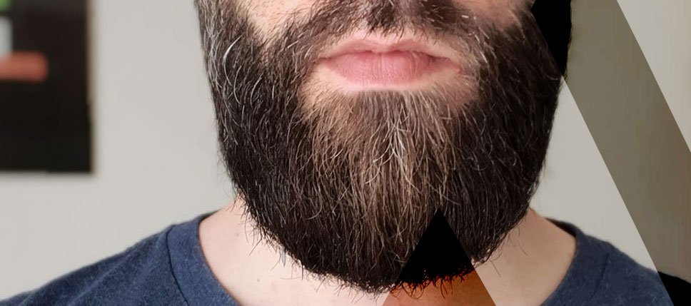 Bart Implantat Türkei 