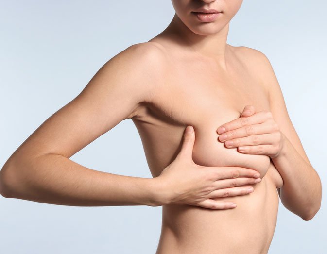 Lipofilling der Brust