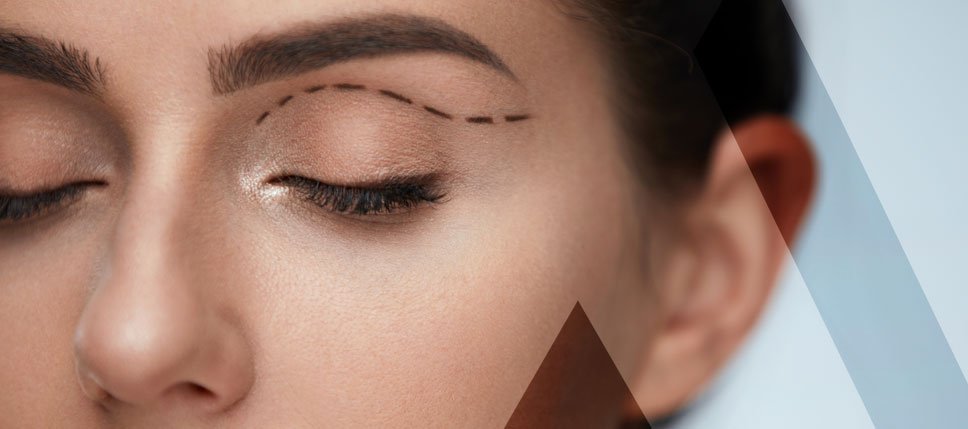 Blepharoplastik Türkei