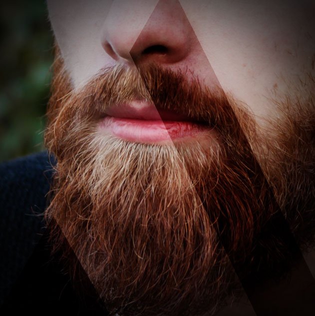 Bart Implantation Kosten