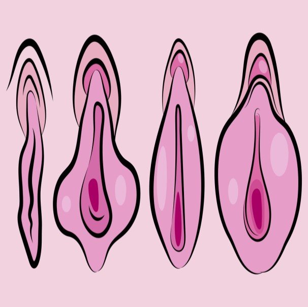 Vaginoplastik Türkei